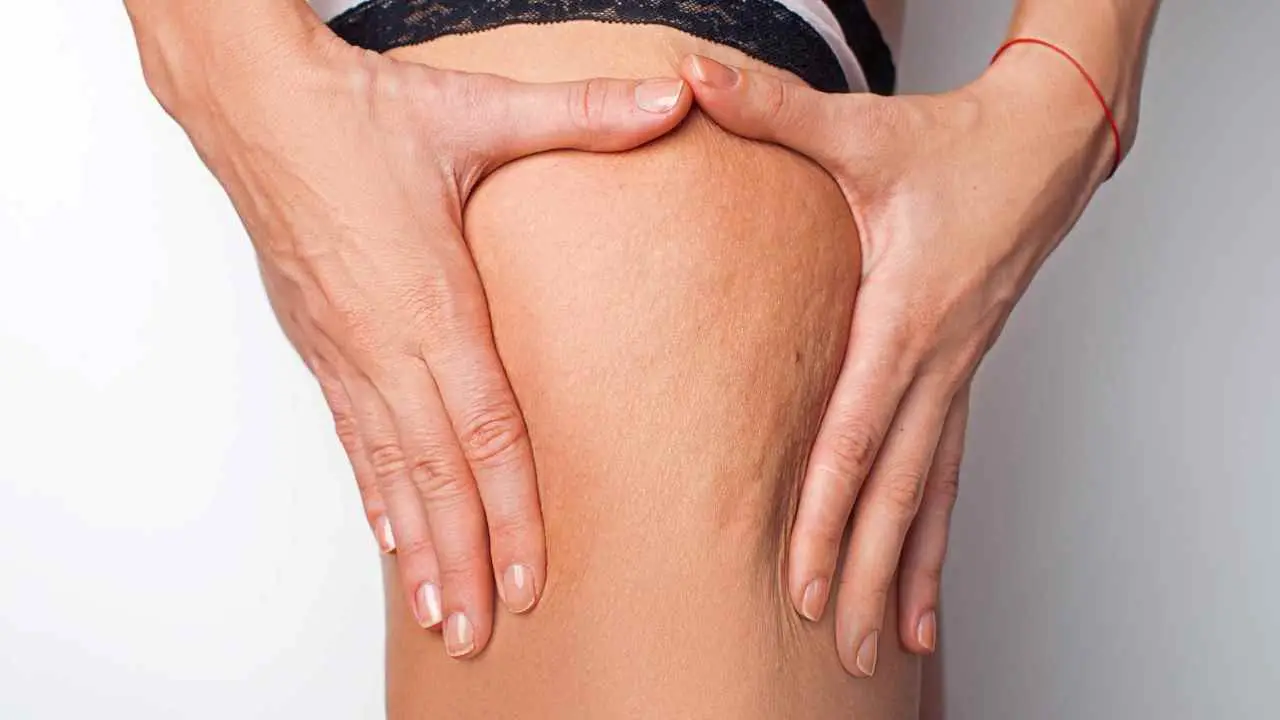 Cellulite: non dipende da quello che mangi, ma da come lo mangi La scoperta che cambia tutto